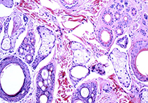 INFINITY 3-6UR sample image of tissue