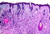 INFINITY 3-1UR sample image of Mammal Peripheral Nerve