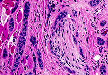 INFINITY 3-1UR sample image of Mammal Ovarian Follicles