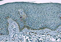 INFINITY 3-1UR sample image of Mammal Kidney