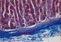 INFINITY 3-6UR sample image of tissue