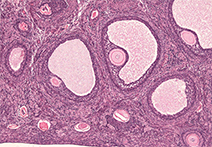 INFINITY 3-1UR sample image of Mammal Ovarian Follicles