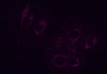 INFINITY 3-1 image of mouse endothelioma