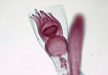INFINITY 3-3UR sample image of tissue