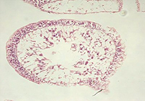 INFINITY 1 sample image of arteries and vein