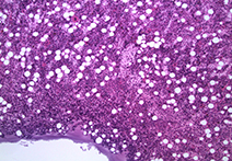 INFINITY 1 sample image of Mammal Bone Marrow