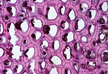 INFINITY X-21 sample image of Persimmon Endosperm